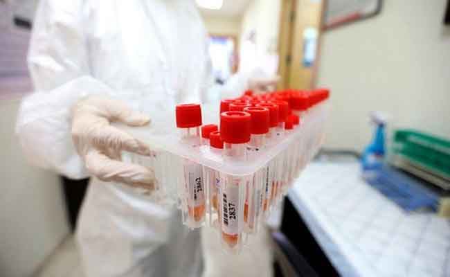 الجزائر تقترب من 66 ألف حالة إصابة بكورونا و عدد الوفيات يصل إلى 2125 وفاة