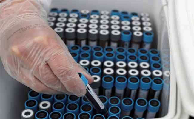 الجزائر تحطم رقما قياسيا في عدد الإصابات بكورونا منذ ظهور الوباء