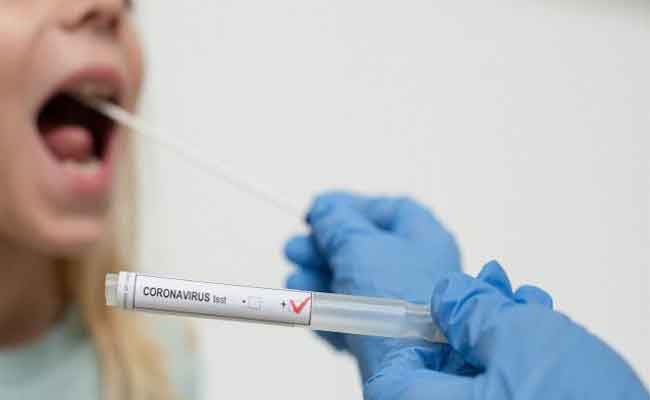 الجزائر تصل إلى عتبة 77 ألف حالة إصابة بكورونا