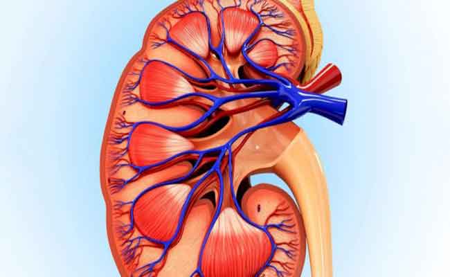 ما هو الرجيم الذي يساعد مرضى الكلى في السيطرة على الأعراض؟