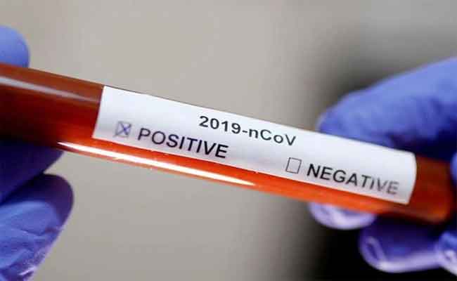 تسجيل 953 حالة إصابة جديدة بكورونا  و 16 حالة وفاة و 596 حالة شفاء خلال 24 ساعة الأخيرة