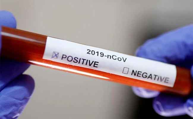 تسجيل 573 إصابة جديدة بفيروس كورونا و 11 وفاة