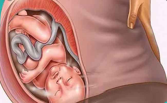 هذه هي التغيّرات التي تطرأ على رأس الجنين أثناء الولادة…