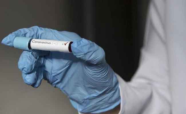 الجزائر تسجل 258 إصابة جديدة بكورونا و 3 وفيات و 198 حالة شفاء