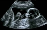 متى تضرّ الصور الشعاعية بالجنين خلال الحمل...؟
