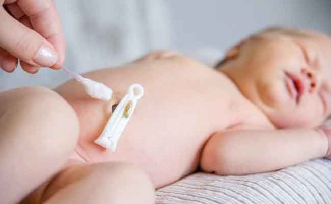 ما سبب وجود الدم في سرة المولود بعد سقوطها؟ وهل ما يدعو للقلق؟