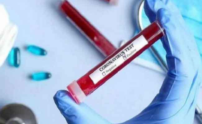 الجزائر تسجل 248 إصابة جديدة بكورونا و 5 وفيات و 194 حالة شفاء