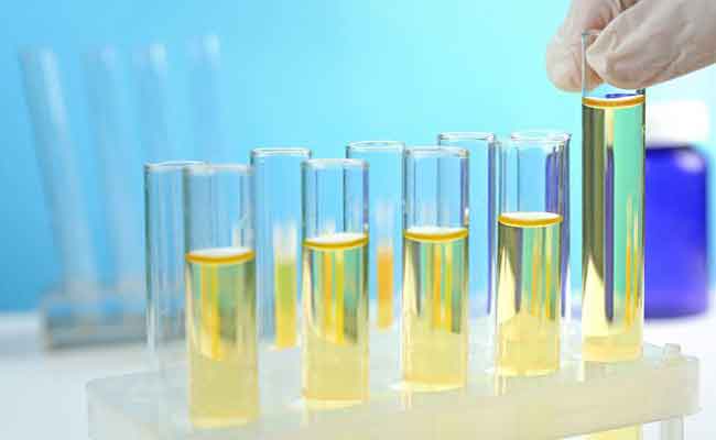 ما الذي تشير اليه رائحة البول الكريهة عند الحامل؟