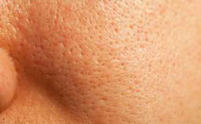 كيف تضيّقين مسام بشرتكِ الواسعة؟