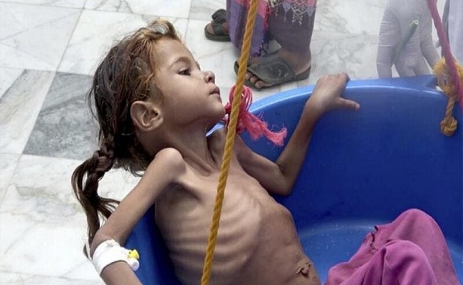 خطر المجاعة يهدد 3 دول عربية