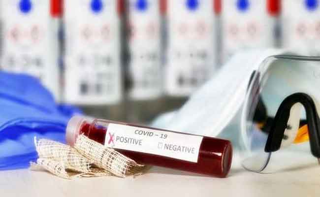 تسجيل 242 إصابة جديدة بكورونا و 9 وفيات بالجزائر