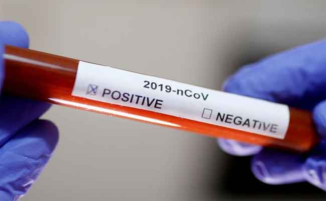 الجزائر تسجل 186 إصابة جديدة بكورونا و  132 حالة شفاء و  9 وفيات