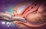 كيف يمكن توسيع عنق الرحم وتحفيز الولادة؟