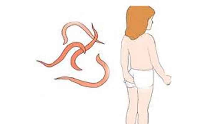 كيف يمكن التعرف على اعراض الديدان عند الأطفال؟