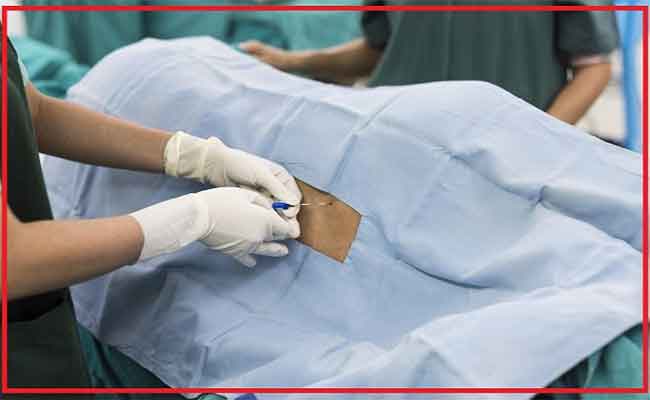 هل لابرة الظهر خلال الولادة اضرار على المدى البعيد؟