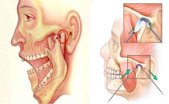 طقطقة الفك عند الطفل…هل ما يدعو للقلق؟