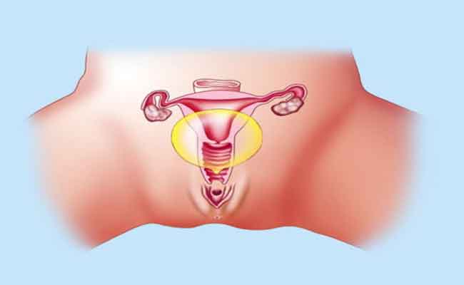 هل ممكن رؤية غشاء البكارة بالعين المجردة؟