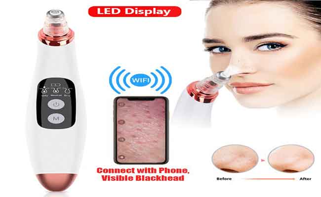 جهاز شفط الرؤوس السوداء…حلّ سريع لمشكلة جمالية شائعة!