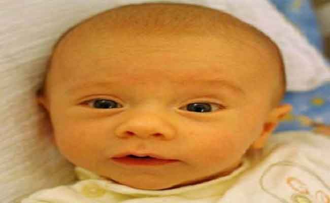 ما أسباب التهاب الكبد لدى حديثي الولادة؟