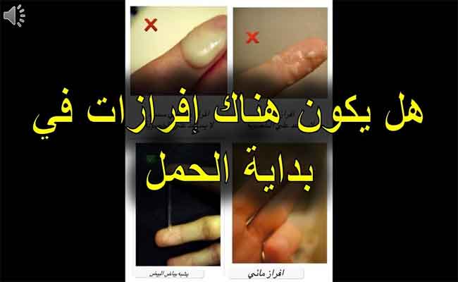 ما هي دلالات نزول إفرازات بنية بعد تأخر الدورة الشهرية؟