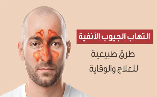 ما هي العلاجات المتاحة لإلتهاب الجيوب الانفية؟