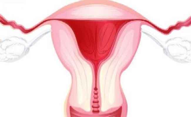 كلّ ما تريدين معرفته عن انواع التهاب المهبل والعوامل المسبّبة له