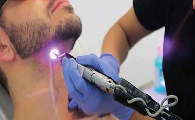 لماذا يعتبر الليزر من أفضل التقنيات للتخلص من الشعر؟