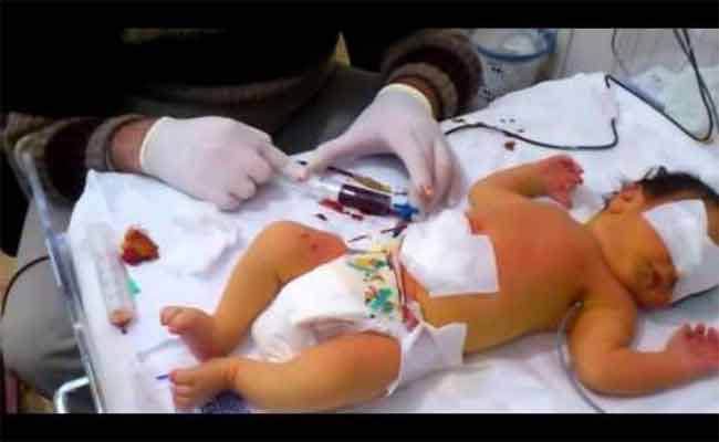 ما الذي يسبّب تكسّر الدم عند الرضع؟