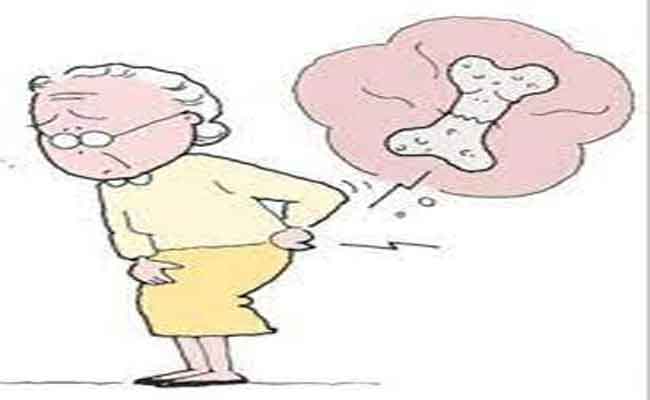 إنقطاع الطمث…هل يعرّضكِ للإصابة بهشاشة العظام؟