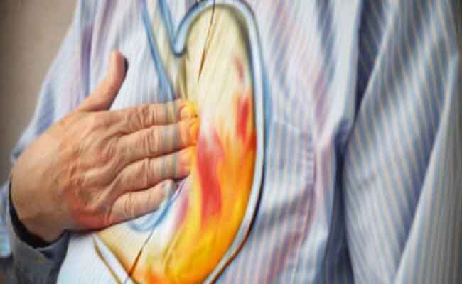 أي مشروبات تساعدكم في التخلّص من حموضة المعدة؟