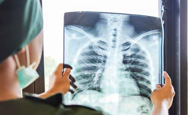 في أيّ حالاتٍ تكون زراعة الرئة مطلوبة؟