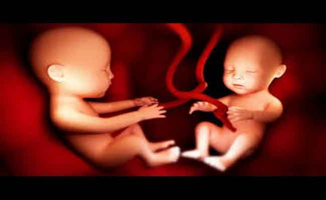 كيف تعرفين انكِ حامل بتوأم منذ الشهر الأول؟