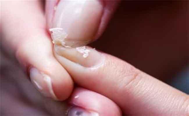 إذا كانت أظافرك تتكسّر اكتشفي الاسباب وراء هذه المشكلة…