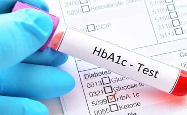 حقائق من المهمّ ان تعرفوها عن فحص السكر التراكمي…