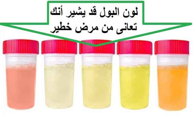 تغير لون البول عند الرجل…هل هناك ما يدعو للقلق؟