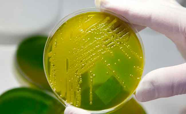 أوّل وفاة في بريطانيا بسبب متحور أوميكرون…وبيان لمنظمة الصحة العالمية