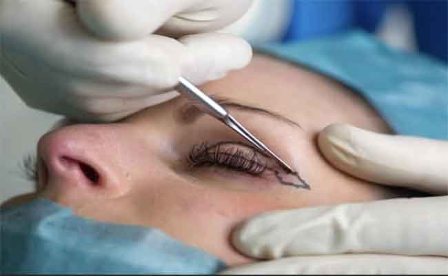 هل تفكّرين باجراء جراحة تحديد الجفون؟ اليكِ ما يجب أن تعرفيه عنها