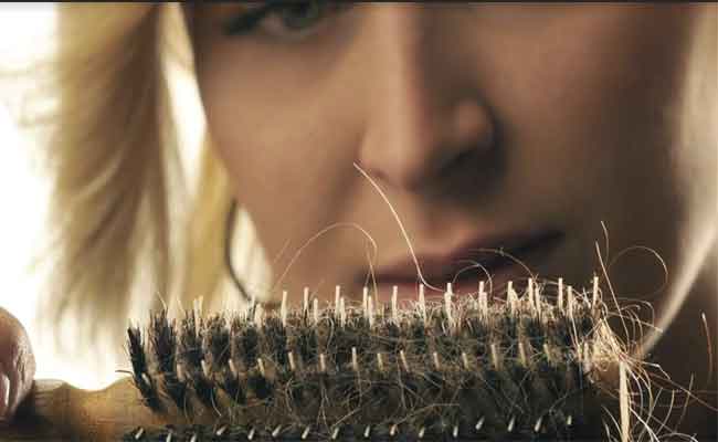 هل التوتر يمكن أن يؤدي فعلاً الى تساقط الشعر؟