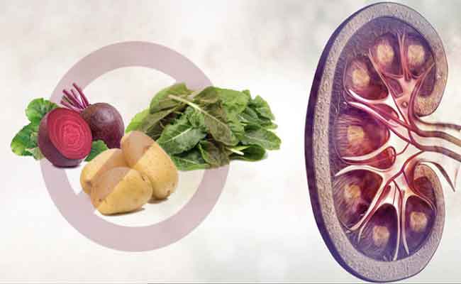 أي أطعمة تساعد على منع تكوّن حصى الكلى؟