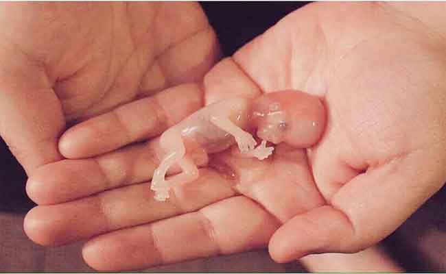 ما أسباب الإجهاض في الشهر الأول من الحمل؟