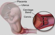 في أي حالاتِ تحتاجين الى ربط عنق الرحم خلال الحمل؟