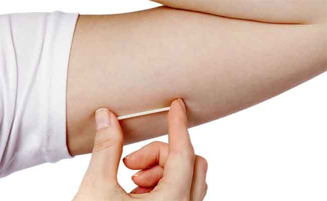 ماذا تعرفين عن وسيلة منع الحمل المزروعة؟