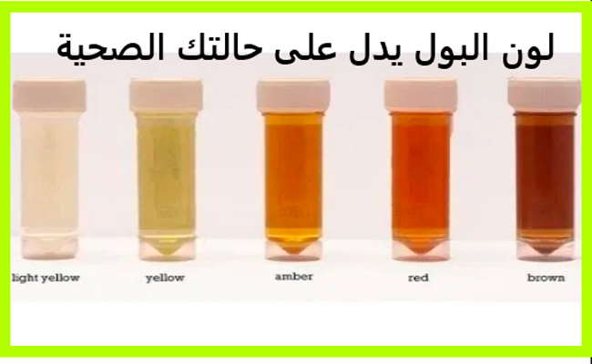 على ماذا يدلّ لون البول عند الأطفال؟
