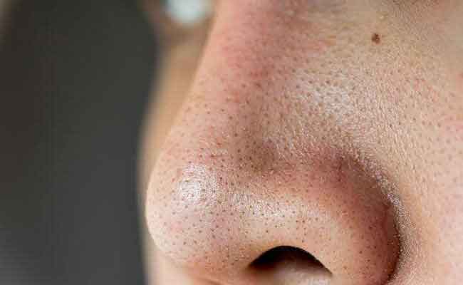 نصائح لتقليص المسامات الواسعة والعميقة في البشرة…