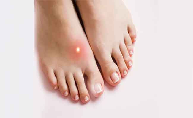 هذه هي الخطوات الصحيحة للتعامل مع فقاعات القدم…