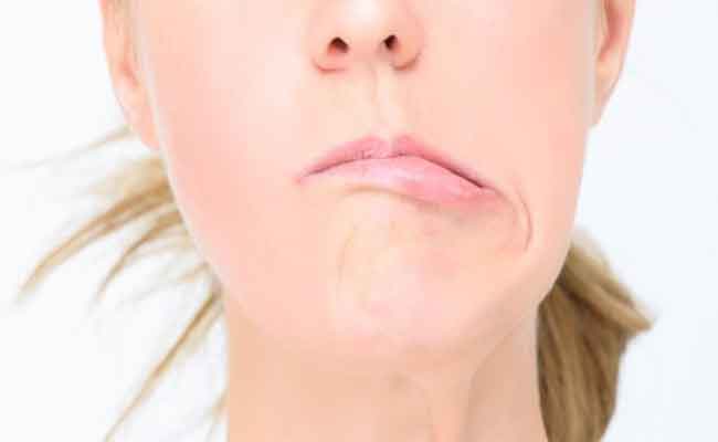 كلّ ما تريدون معرفته عن ألم العصب الخامس…