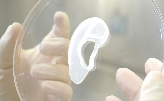 زراعة أذن بشرية باستخدام غرسة مطبوعة بتقنية ثلاثية الأبعاد...