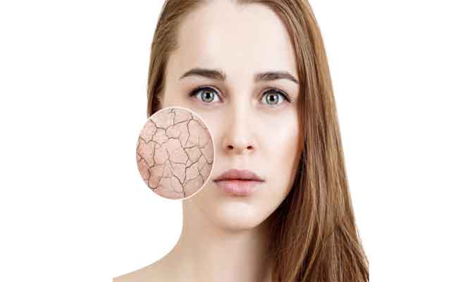 إذا كنتِ تعانين من جفاف وشحوب البشرة…إليكِ الأسباب والحلول!