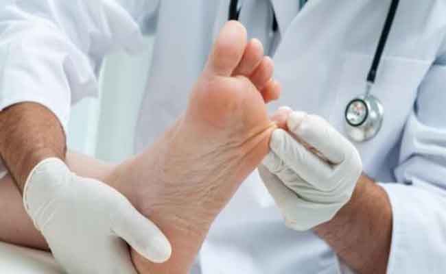 6 نصائح هامة للوقاية من الفطريات الجلدية في الصيف…