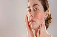 كيف يمكن أن تحمي بشرتكِ من الالتهابات؟